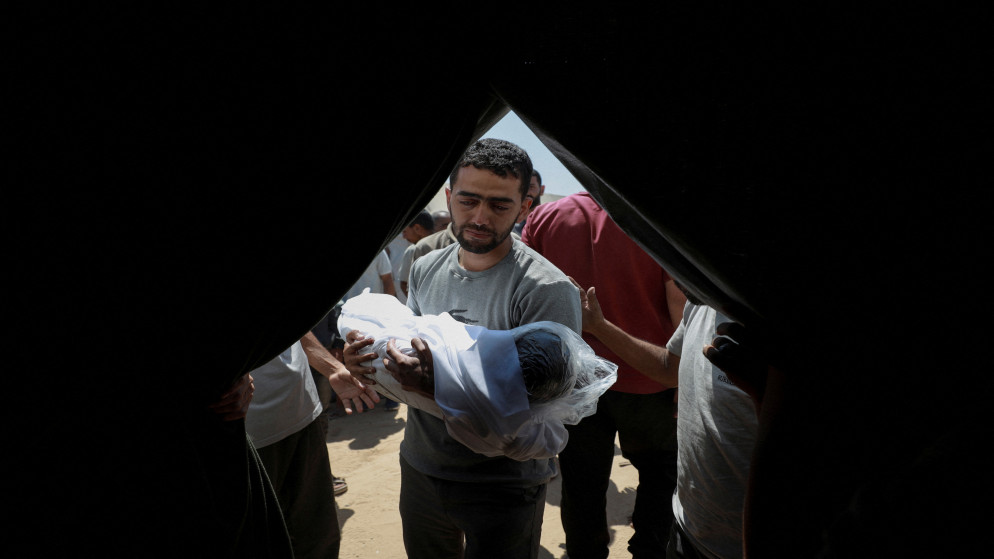 وفاة طفلة نتيجة سوء التغذية في غزة و17 ألفا آخرون يعانون منه