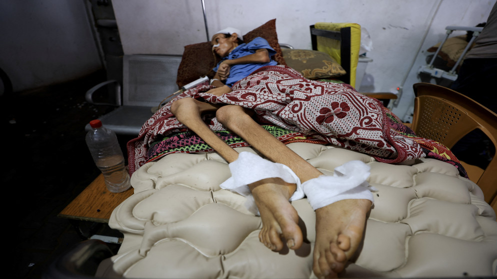 "صحة غزة": تسجيل 45 حالة شلل رخو حاد خلال حزيران وتموز